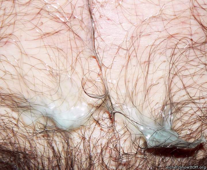 seed on my chest hair