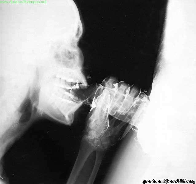 jimndonnaJim turned my BLOWJOB into an XRAY