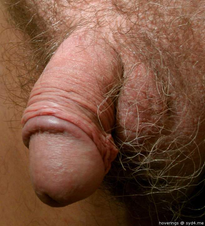 wow ! That's hairy.