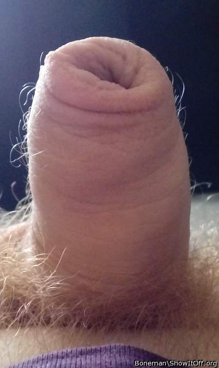 A Foreskin With Hairs