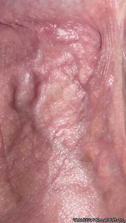 Veins in the shaft with skin pulled back. (The 2 Y�s!)