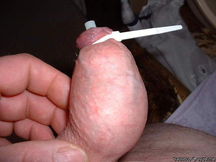 Piss into the foreskin, just before to burst