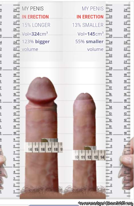 Penis extender vs my penis