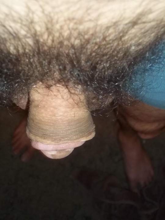 a little more foreskin