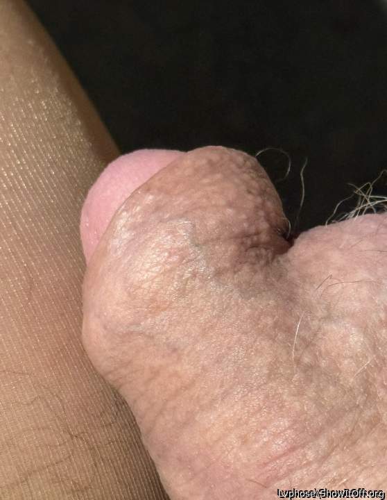 Adult image from Lvphose