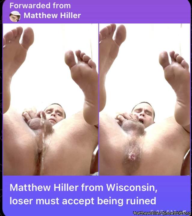 I must accept I am outed and must admit I�m a gay bottom with a micro size penis