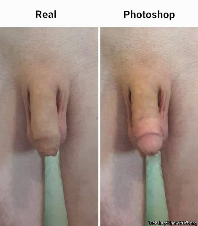 I'm considering getting circumcised.  What do you think?