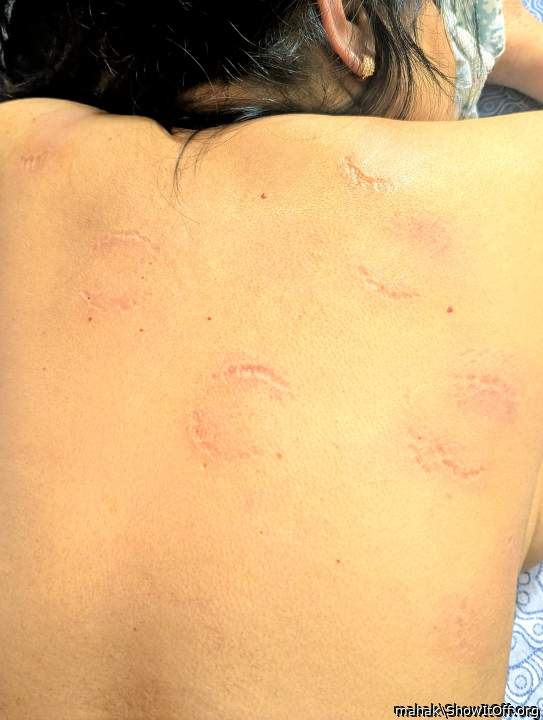 Adult image from mahak