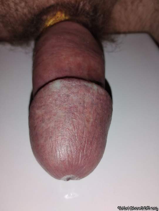 Adult image from Cbtbc