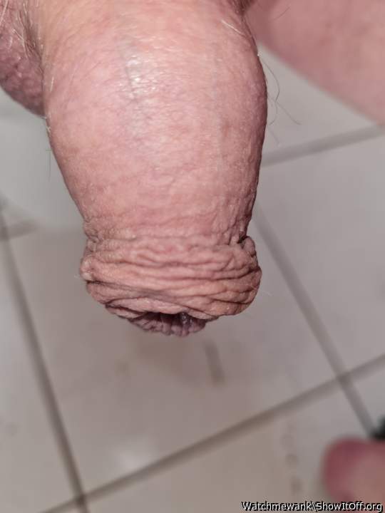 Foreskin 2