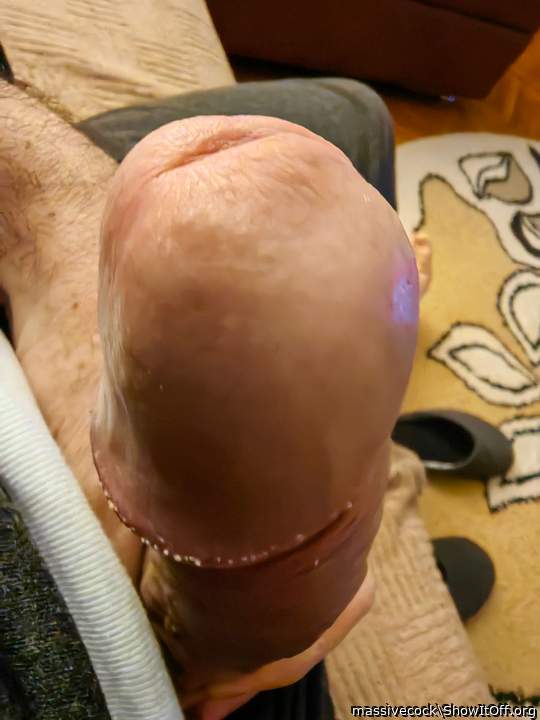 Nice juicy fat head and I like the pearly penile papules aro