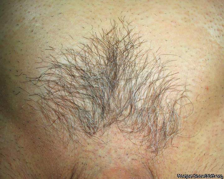 One last look at the patch before shaving.....