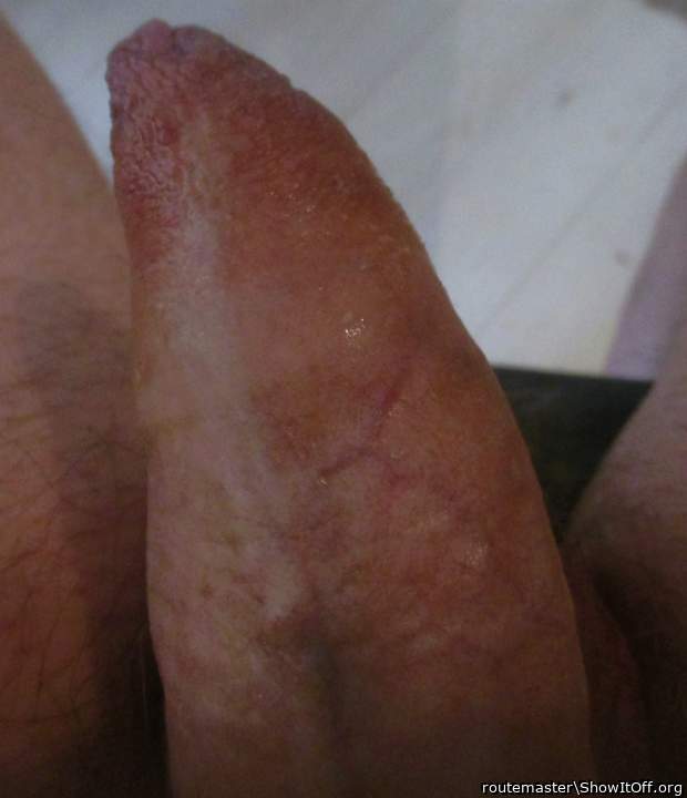 My early morning uncut dick, 20.9.24