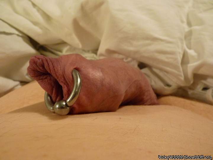 My infibulated foreskin